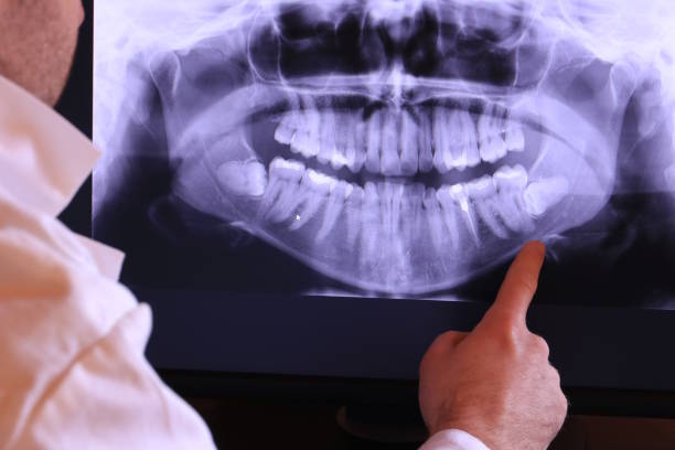 Best Emergency Care for Gum Disease in Lago Vista, TX